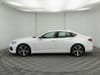 9 thumbnail image of  2025 Acura TLX Technology Package