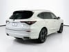5 thumbnail image of  2026 Acura MDX Advance Package