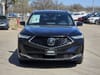 2 thumbnail image of  2026 Acura MDX Advance Package