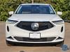 2 thumbnail image of  2022 Acura MDX Technology