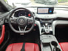 12 thumbnail image of  2025 Acura TLX A-Spec Package