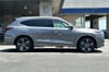 2 thumbnail image of  2026 Acura MDX Advance Package