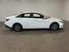 2 thumbnail image of  2024 Hyundai Elantra SEL