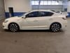 6 thumbnail image of  2018 Acura ILX Premium and A-SPEC Packages
