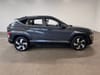 2 thumbnail image of  2024 Hyundai Kona Limited