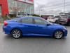 5 thumbnail image of  2018 Honda Civic Sedan SE