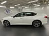 2 thumbnail image of  2024 Acura TLX Technology Package
